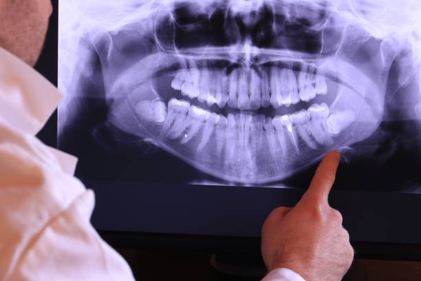 Best Emergency Treatment for Toothache in Farragut, TN